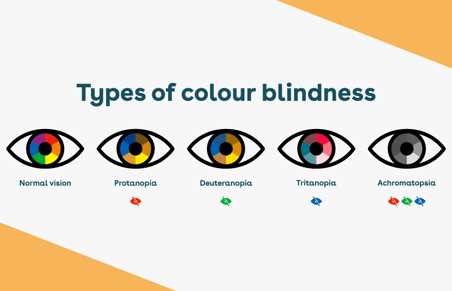 Shows different types of colour blindness (deficiency)